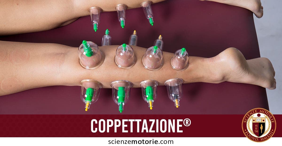 Coppettazione: trattamento per un recupero veloce