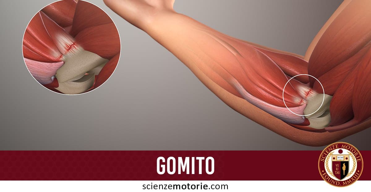 Gomito: Tipologie di Infortunio