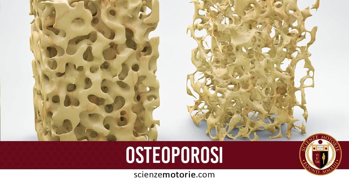 Osteoporosi: tutto quello che c’è da sapere