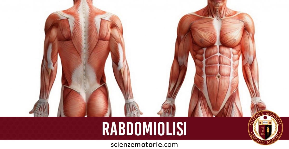 Rabdomiolisi: Sintomi e Diagnosi