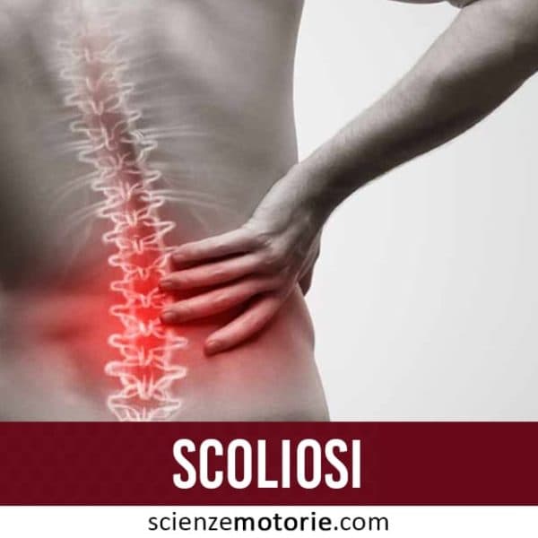 Scoliosi
