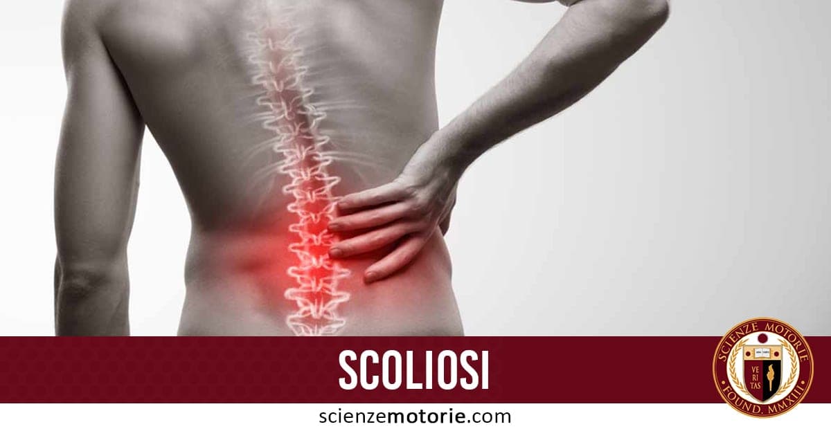 Scoliosi