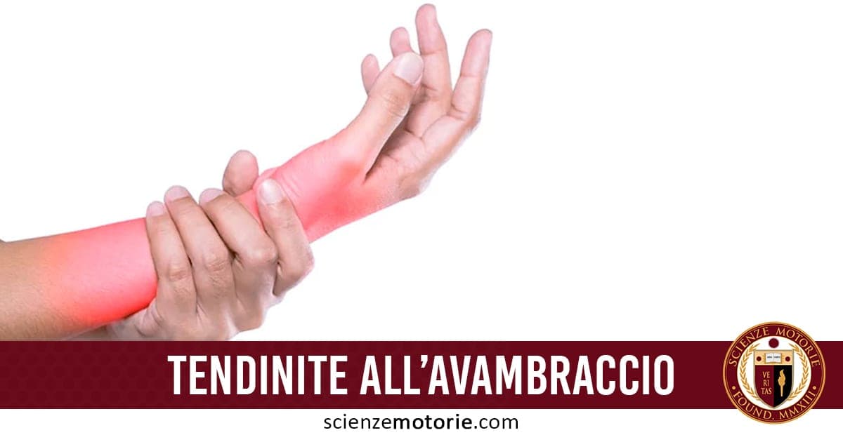 Dolore dell’Avambraccio: Sintomi e Trattamenti della Tendinite