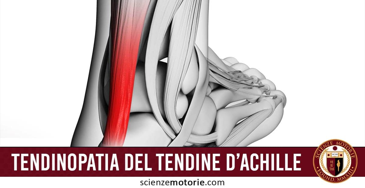 Tendinopatia del Tendine d’Achille