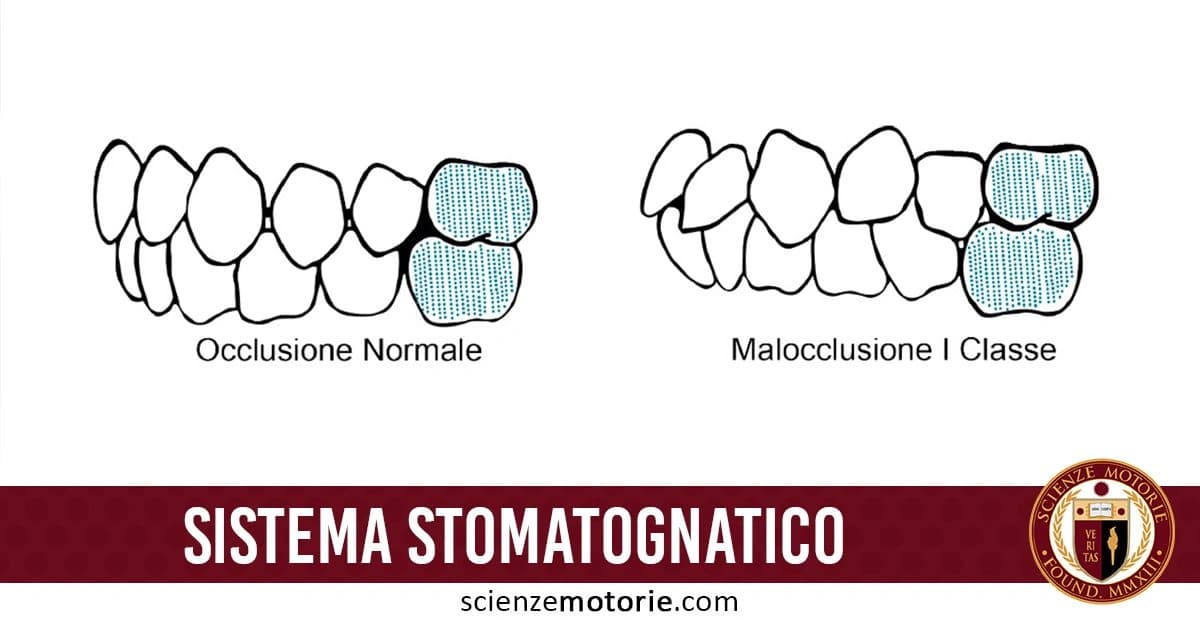 L'immagine mostra due diagrammi del sistema dentario: a sinistra, l'illustrazione di un'"Occlusione Normale", mentre a destra una "Malocclusione I Classe". Entrambi i diagrammi evidenziano la posizione dei denti e gli allineamenti possibili. In basso, appare la scritta "SISTEMA STOMATOGNATICO" accompagnata dal logo di scienzemotorie.com